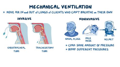 Artificial ventilation .